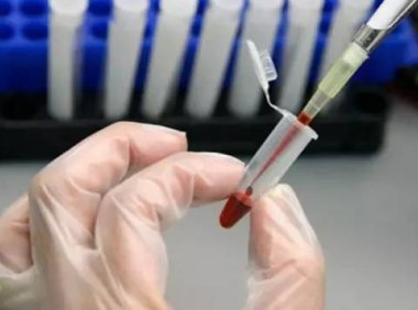 葛兰素史克长效注射抗HIV进入三期临床试验
