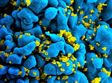 常见抗生素可减少HIV感染者的不良健康事件